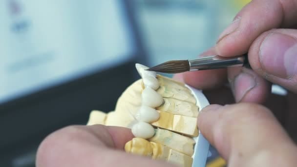 Імплантація зубів Луцьк — Дентіка